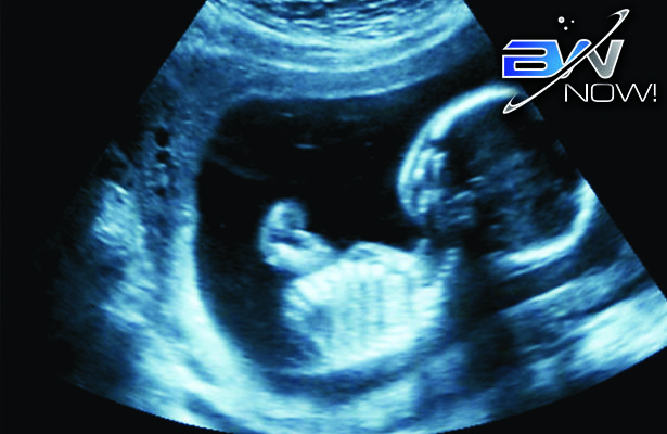 Pain Threshold: Pro-Choice Scientist Finds Fetal Pain Comes Much Earlier