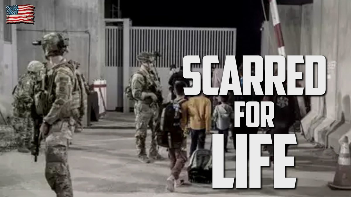 [UPDATE*] SCARRED FOR LIFE