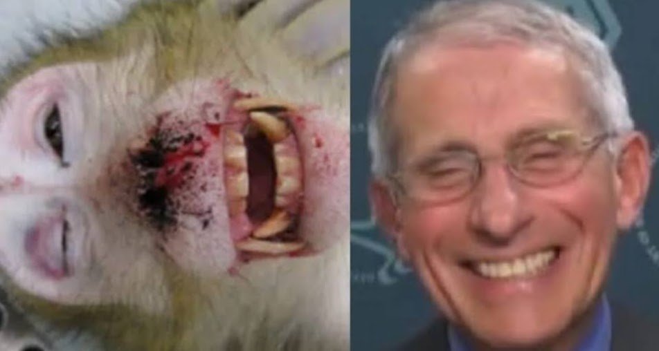 Fauci Psychopath-b6eb2ad2