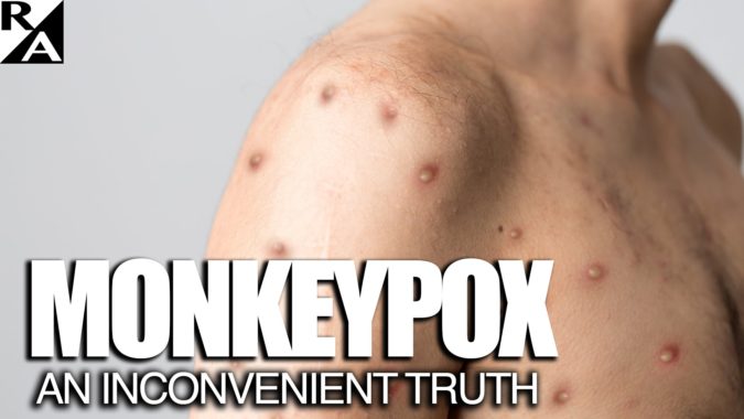 Monkeypox: An Inconvenient Truth